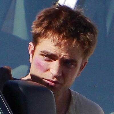 Robert Pattinson mimt Prügelopfer