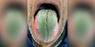 grüne Zunge