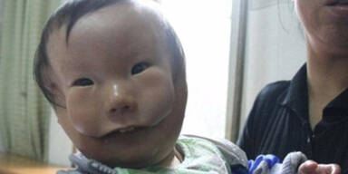 „Masken“-Baby rührt die ganze Welt