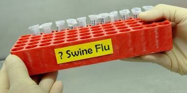 100. Erkrankung mit der Influenza des Typs A(H1N1)