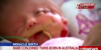 Video des Babys mit zwei Gesichtern