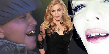 Madonna's neues Gold-Gebiss