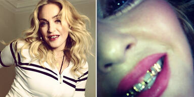 Madonna: "Ich trenne mich nicht von meinen Grillz!"