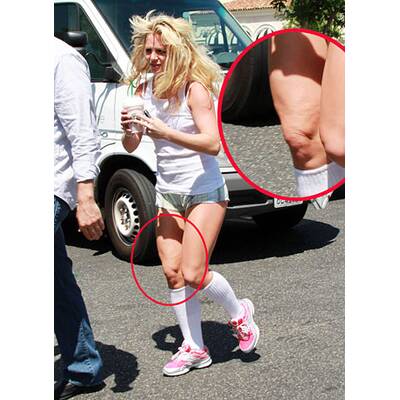 Britney Spears: Cellulite & Auszucker