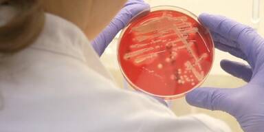 Super-Antibiotikum wird entdeckt