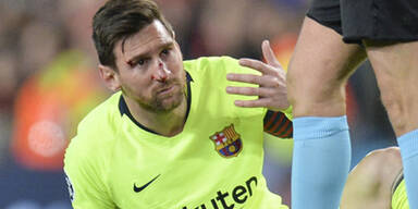 Barca gewinnt 1:0, Blutspiel für Messi
