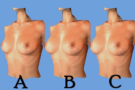 3 Der neue 3D-Scan