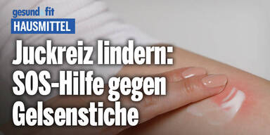 Juckreiz lindern: SOS-Hilfe gegen Gelsenstiche