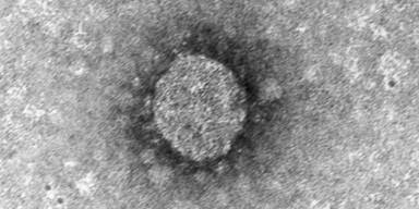 Coronavirus: Die neuesten Fakten über die Gefahr
