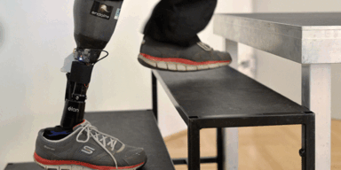 Österreicher bekommt fühlende Beinprothese