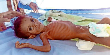 Millionen Kindern droht Hunger-Tod