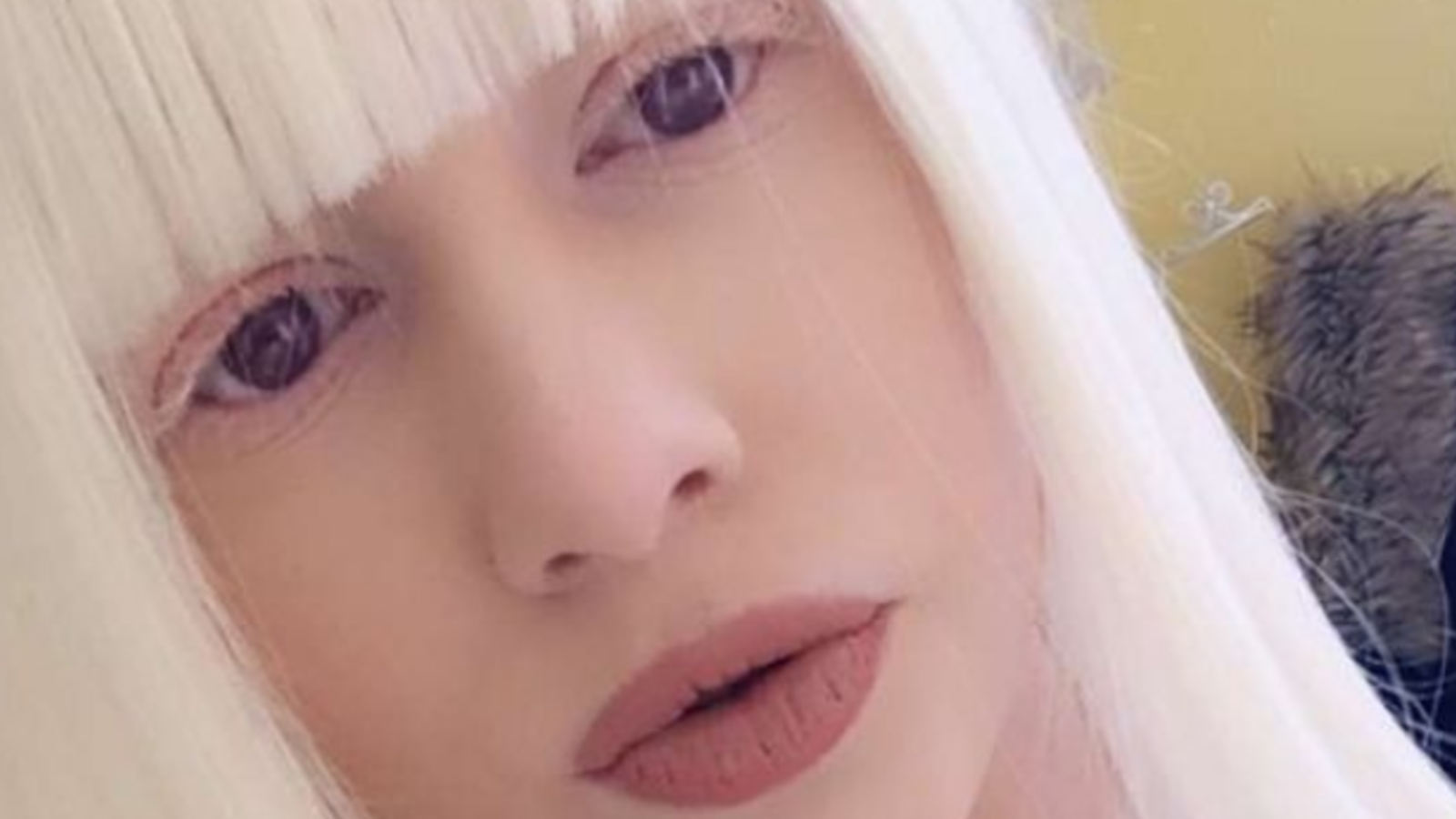 AlbinoMädchen wird gemobbt und diskriminiert oe24.at