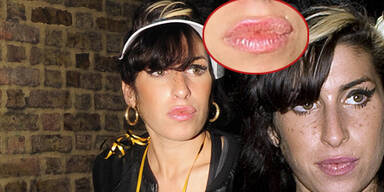 Amy Winehouse: Neue Lippen