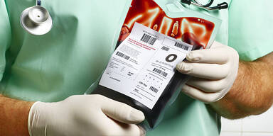 Blutkonserve für bluttransfusion in haenden eines arztes