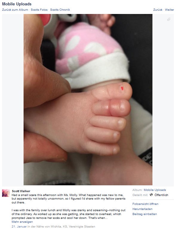 Babyfuß