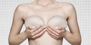 Brustimplantate