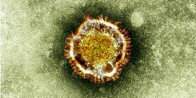 MERS-Virus: Erkrankungsfall in Österreich