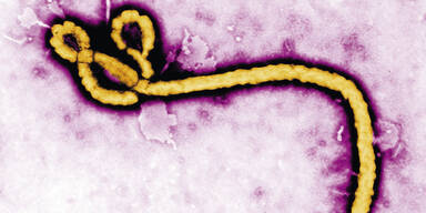 Ebola: Alarm um jungen Linzer
