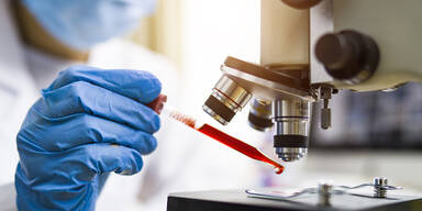 Wiener Forscher machen Durchbruch bei Stammzellenforschung