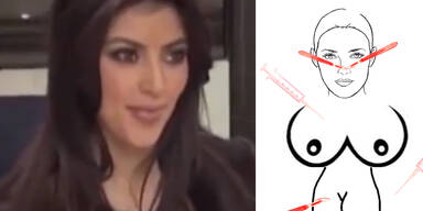 Kardashians: Das alles ist operiert!