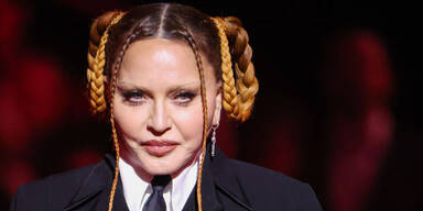 Madonna: Experten verraten ihre Beauty-Eingriffe