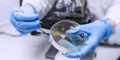Eine Mikrobiologin untersucht eine Probe im Labor (Symbolbild)