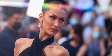 Lyme-Borreliose: Alles über Bella Hadids unheilbare Krankheit - gesund24.at