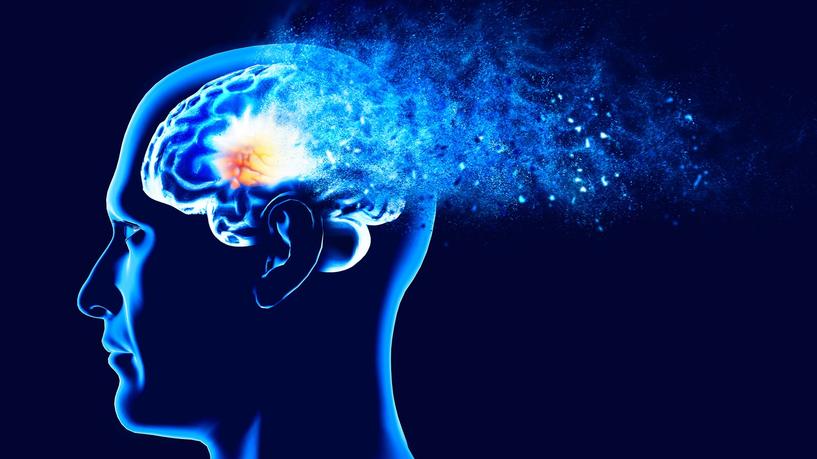 Alzheimer Risiko Senken? Ist Lithiummangel Der Zündfunke Für Alzheimer? Experten Tipps! - r9za658