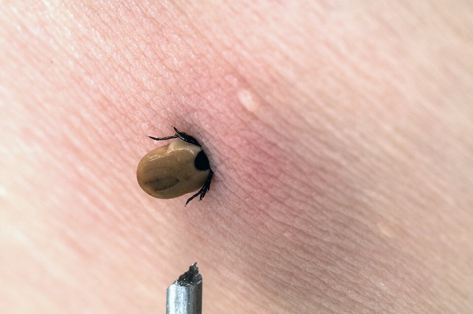 Zecken-Check: Nach einem Aufenthalt im Freien empfiehlt es sich, den Körper und die Kleidung nach Zecken durchzusuchen.