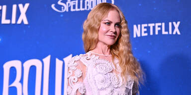 Enthüllt: DARUM sieht Nicole Kidman viel jünger aus, als sie ist