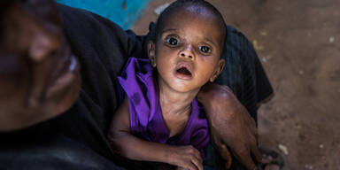 Somalia Hungersnot