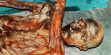 Gletscher-Mumie "Ötzi"