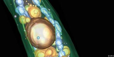 Hefezellen sollen molekulare Mechanismen des Zelltodes klären