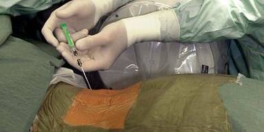 Implantat nur bei schweren Bandscheibenschäden eingesetzt