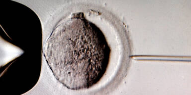 In Vitro Fertilisation IVF