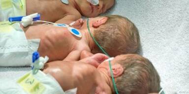 Kaiserschnittkindern haben häufiger Atemwegsprobleme