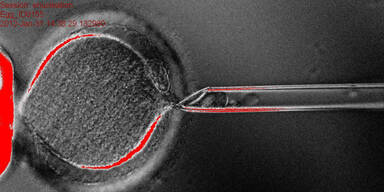 Mensch-Stammzellen durch Klonen erschaffen