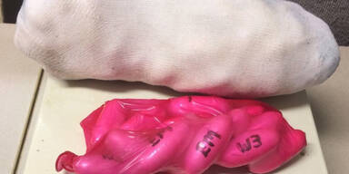 Schwangere mit 75 Drogen-Päckchen erwischt