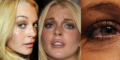 Lindsay Lohan - tiefe Falten mit 23