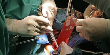 Mangel an Spenderorganen bereitet Chirurgen Sorge
