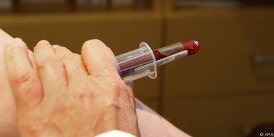 Neue Ansätze zur Steuerung der Blutverdünnung