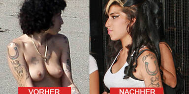 Neue Brüste für Amy Winehouse