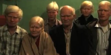 Das ist die größte Albino-Familie der Welt