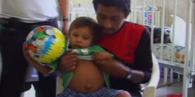 Peru: Dreijähriger trägt Zwilling im Bauch
