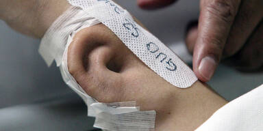 Arzt züchtet Ohr auf Unterarm des Patienten