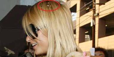 Paris Hilton: Haariges Problem KON
