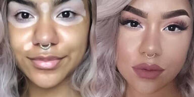 Pigmentstörung Make-up-Artist