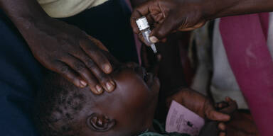 Virus-Alarm: Imfpung löste neue Polio-Form aus