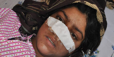Afghane schnitt seiner Frau die Nase ab