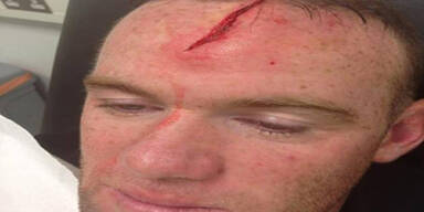 ManU-Star Rooney schockt mit Horror-Foto